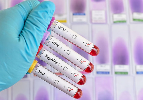 Accessing Affordable Sexual Health Services In Nashville, Tennessee